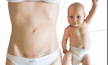 Mommy makeover